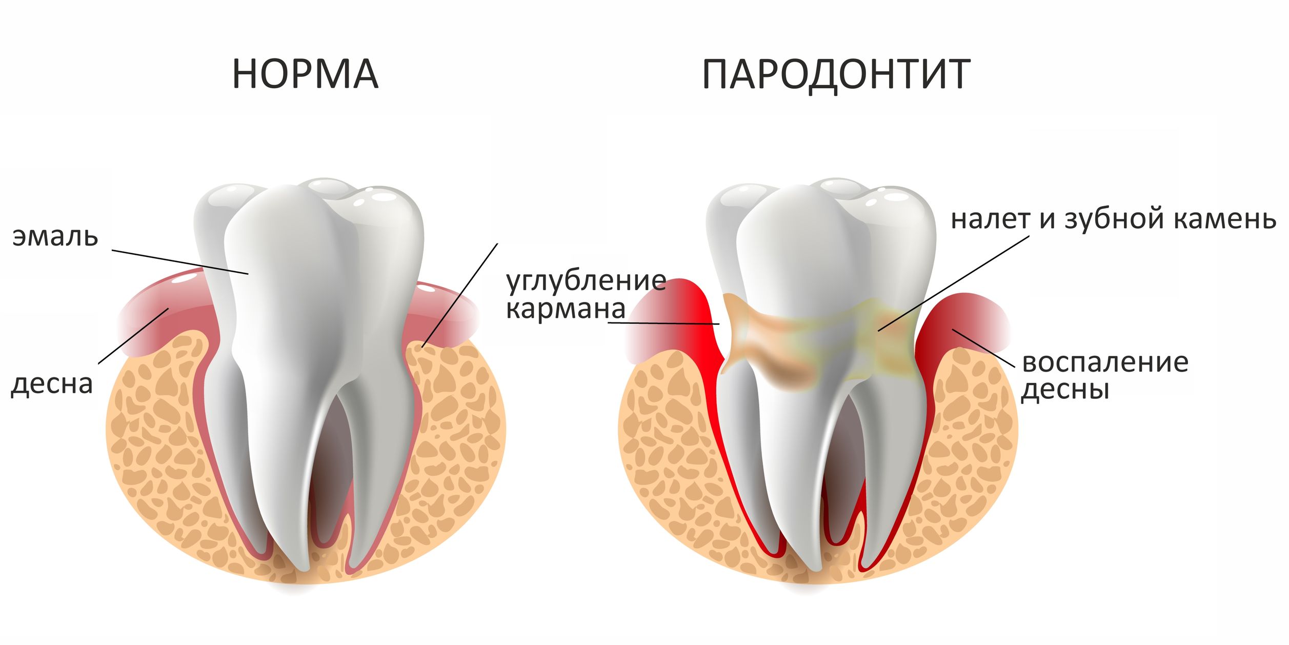 Врач-пародонтолог - что он лечит | Клиника ПрезиДЕНТ на Сухаревской