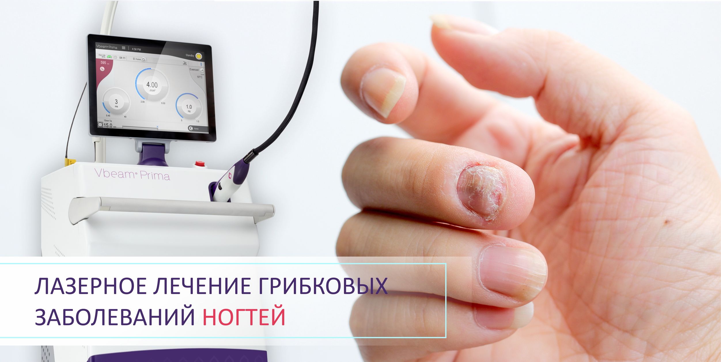 Лазерное лечение грибковых заболеваний ногтей